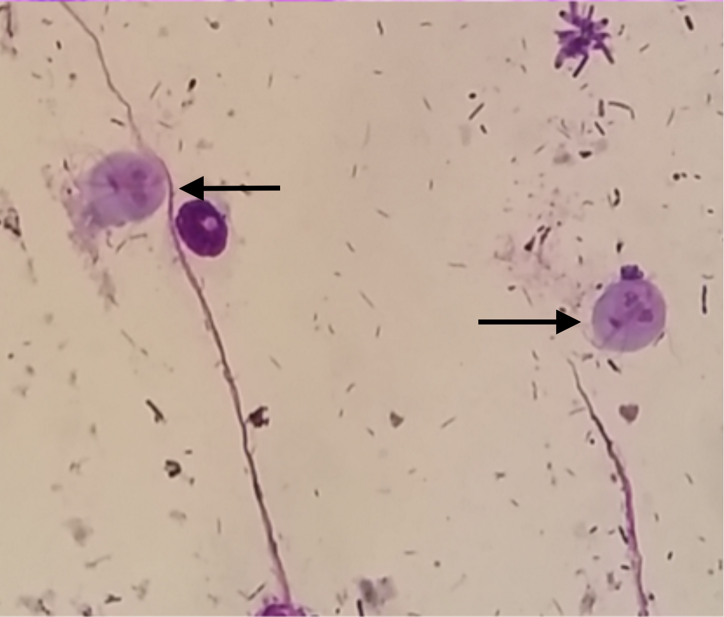 Fig. 1 - Esempio di citologia fecale, si evidenziano 2 forme di Giardia (frecce) e numerosi batteri Image