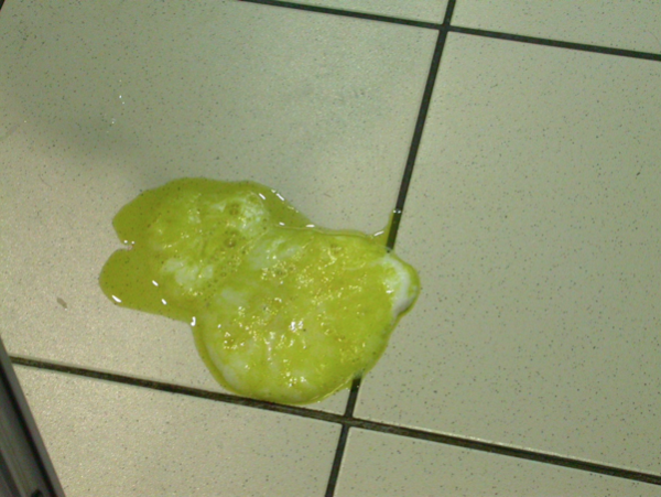 Fig 1 - materiale schiumoso giallastro, compatibile con vomito di saliva frammista a materiale biliare