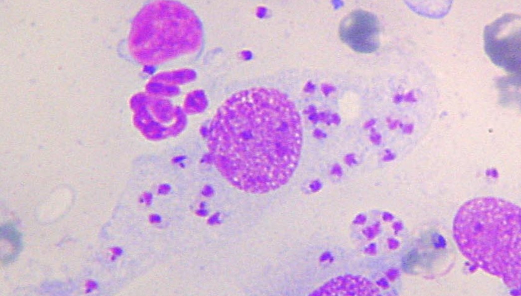 Fig. - numerosi amastigoti di Leishmania infantum ad esame citologico linfonodale di un cane malato. La forma amastigote rispetto a quella del promastigote presente nel Flebotomo, ospite definitivo, perde il flagello per l’esposizione alla temperatura corporea più elevata e sfavorevole rispetto a quella ambientale e si riproduce in forma asessuata. Image