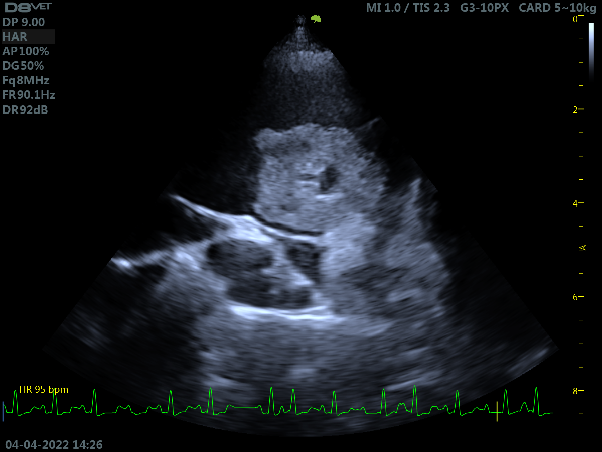 Foto 2 - esempio di neoformazione cardiaca di piccole dimensioni Image