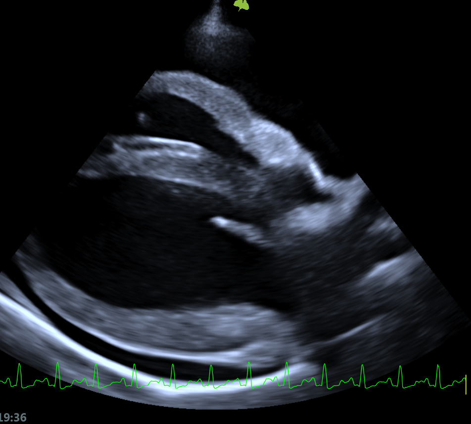 Foto 1 - Cuore con versamento pericardico in un cane Image